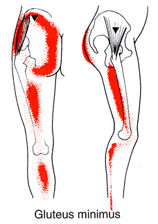 筋・筋膜性疼痛症候群