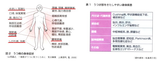 身体症状を訴える患者さんに潜むうつ病・うつ状態の見分け方